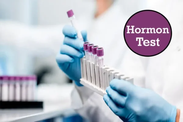 hormonal panel (thyroid, prolactin)