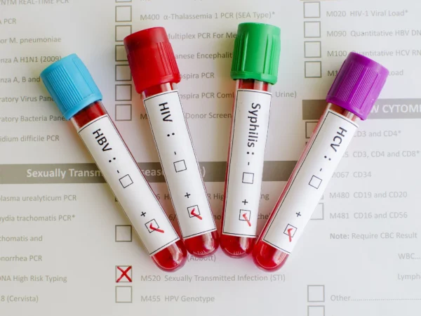 STD Screening (HIV, Hepatitis B & C, Syphilis)