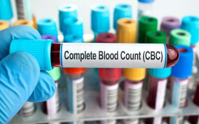 Complete Blood Count (CBC)