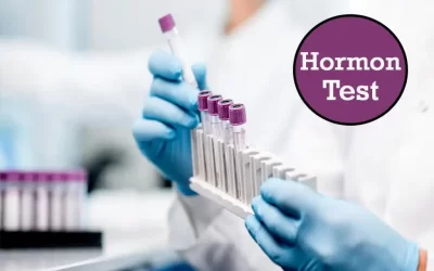 hormonal panel (thyroid, prolactin)