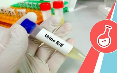 Urine Analyis